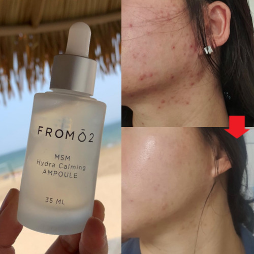 MSM식이유황 수분진정 앰플